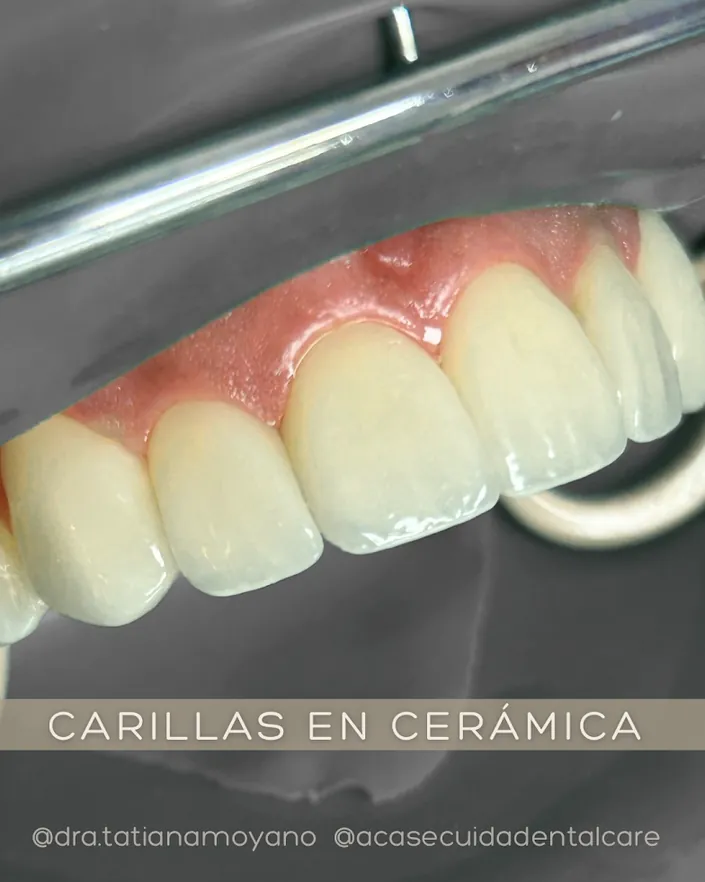 Acá se Cuida Dental Care