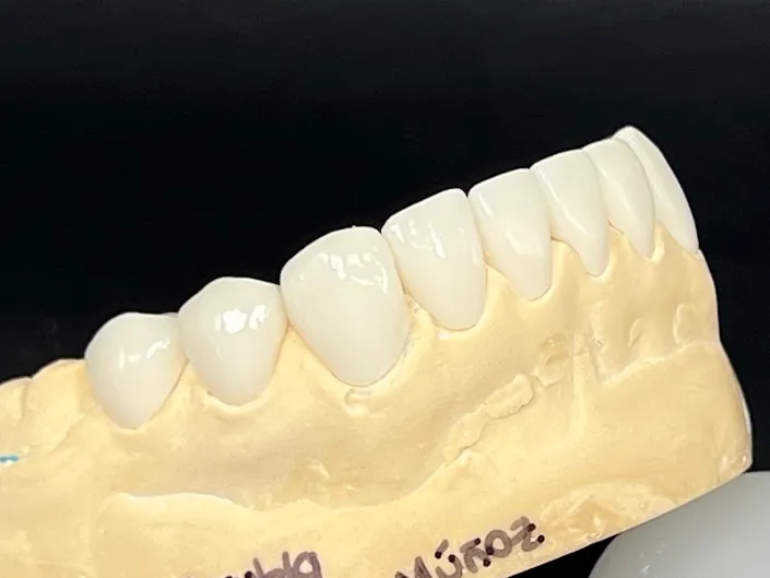 Acryldental