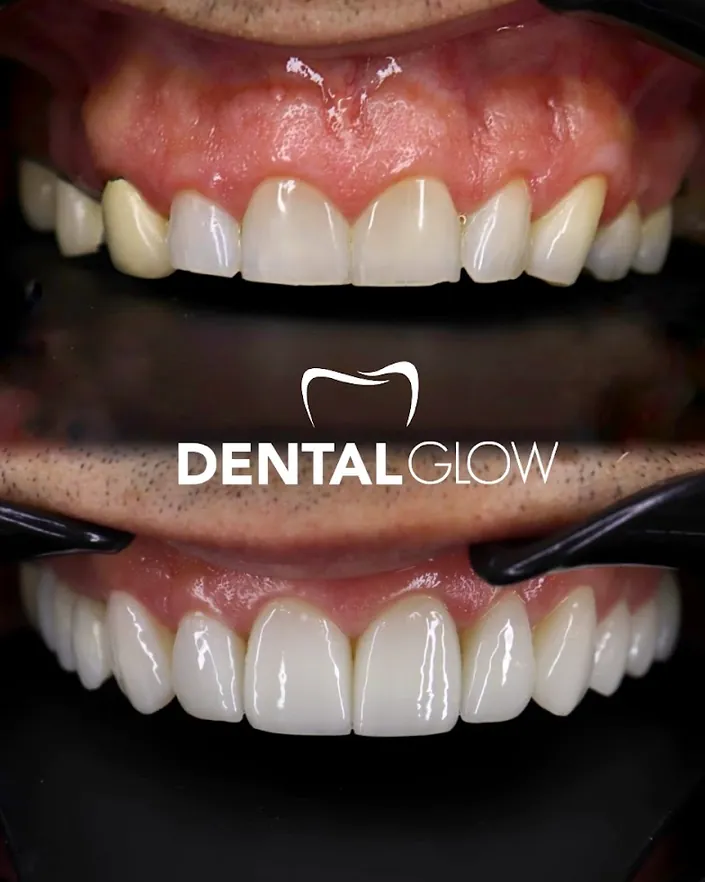 Clínica Dental Glow