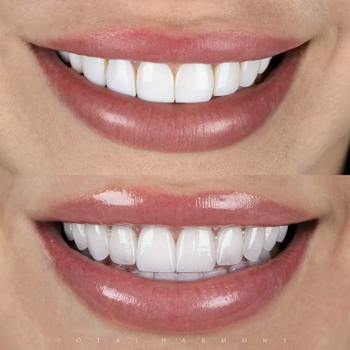 Clínica Total Harmony – Dr. Edison Giraldo