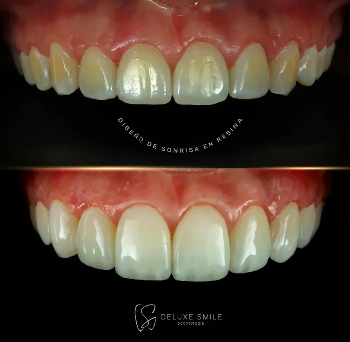 Deluxe Smile