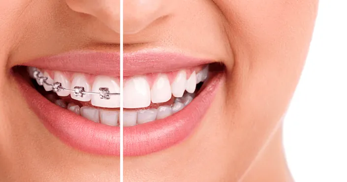 Dentali odontología – Sede Itagüí