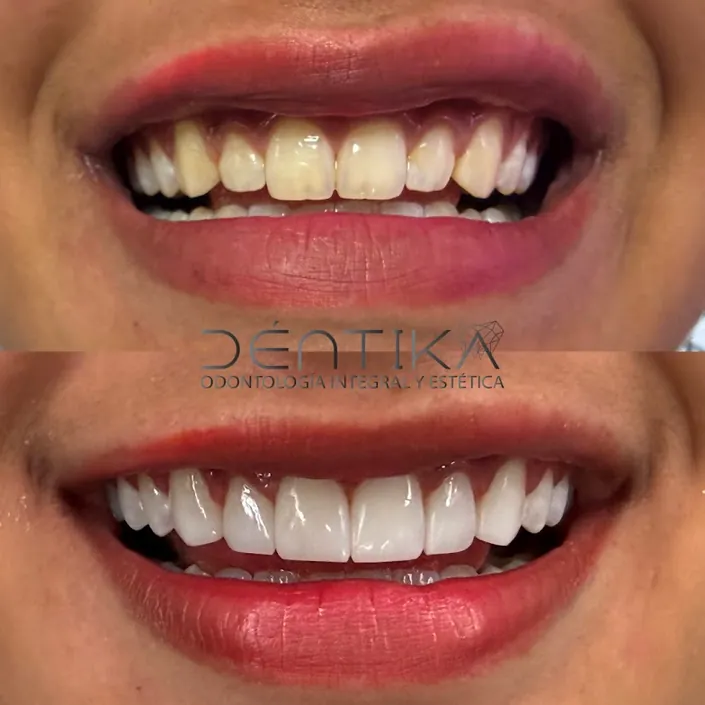 Déntika Clínica Dental