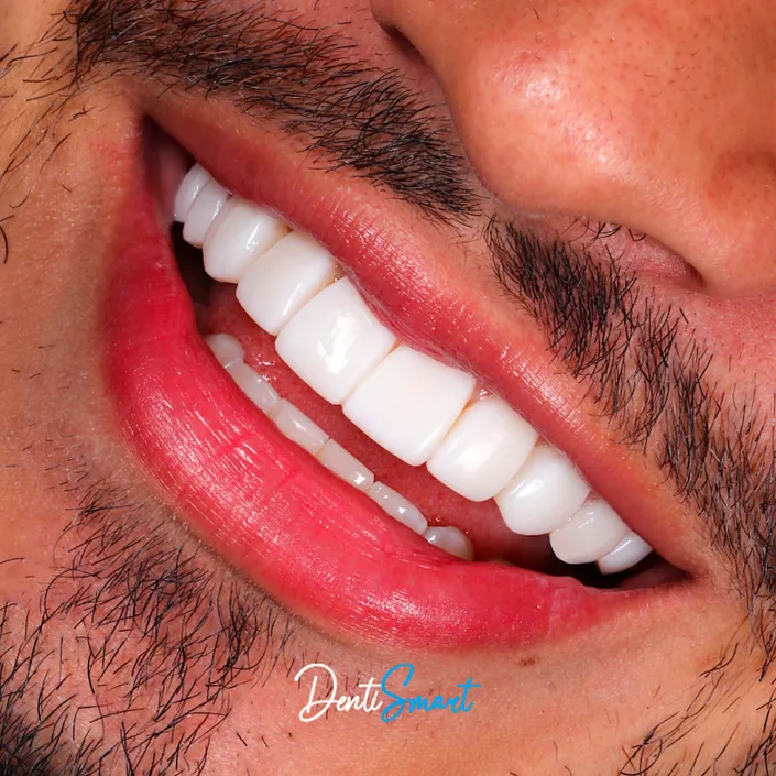 DentiSmart