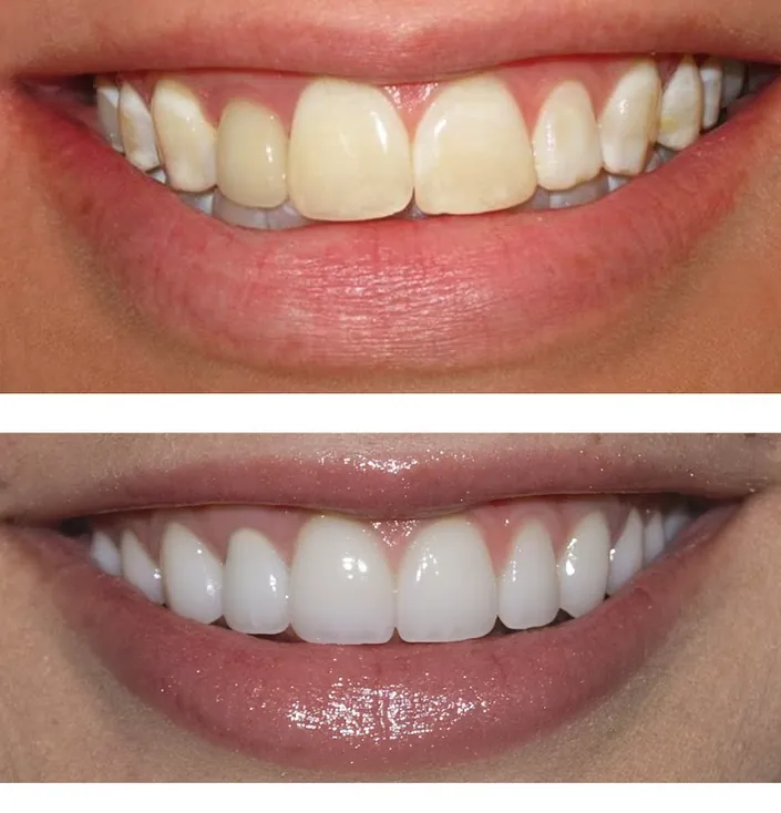 Dientes y Sonrisa