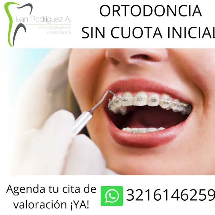 Diseño de Sonrisa Iván Rodríguez A. Odontologia General y Especializada