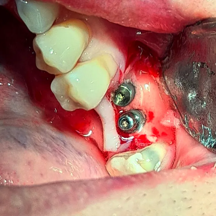 DOCTOR GONZALO MORENO CIRUGIA ORAL Y MAXILOFACIAL ESTOMATOLOGIA