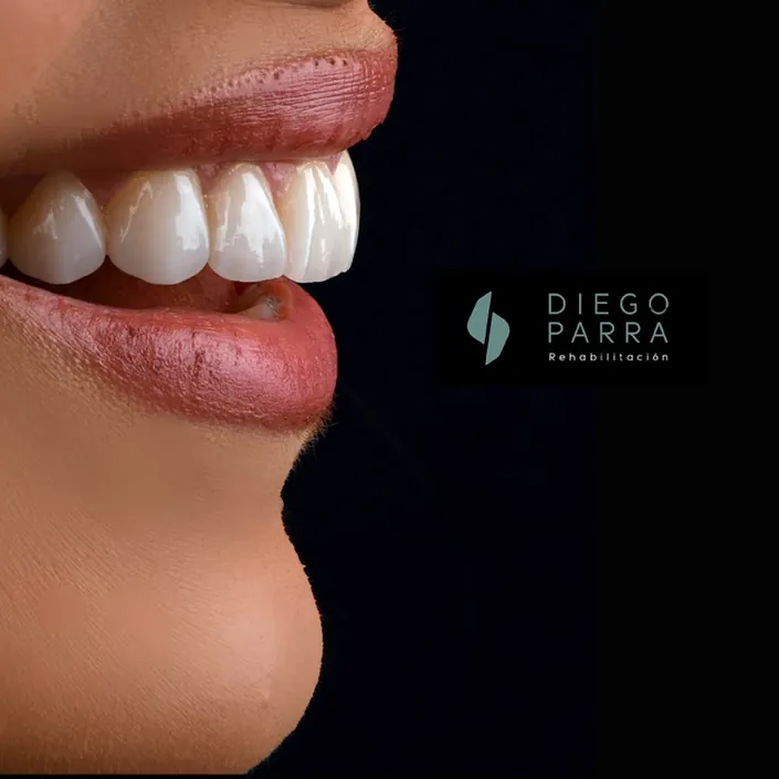 Dr Diego Parra Odontólogo Rehabilitador oral