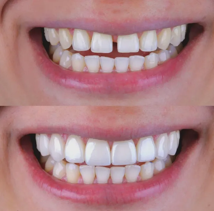 Dr Eduardo Coll | Diseños de Sonrisa en Barranquilla
