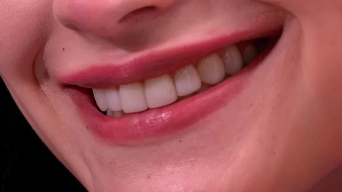 Dr Fernando Marenco Ortodoncia Implantes Dentales Odontologia Especializada