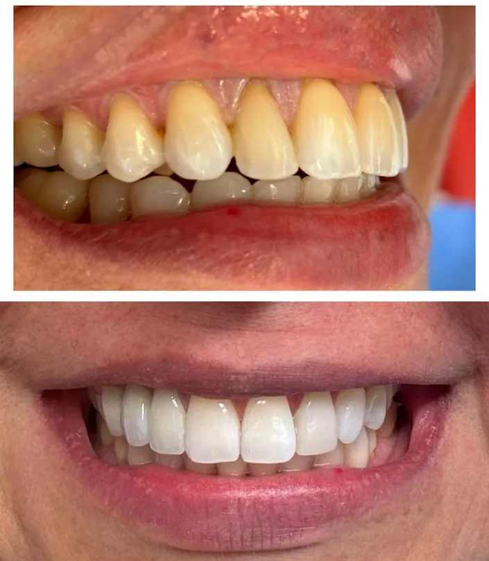 Dra Diana Moreno.Odontologia estética integral
