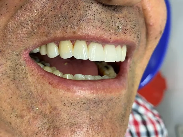 Dra Karina Domínguez Odontología Estética