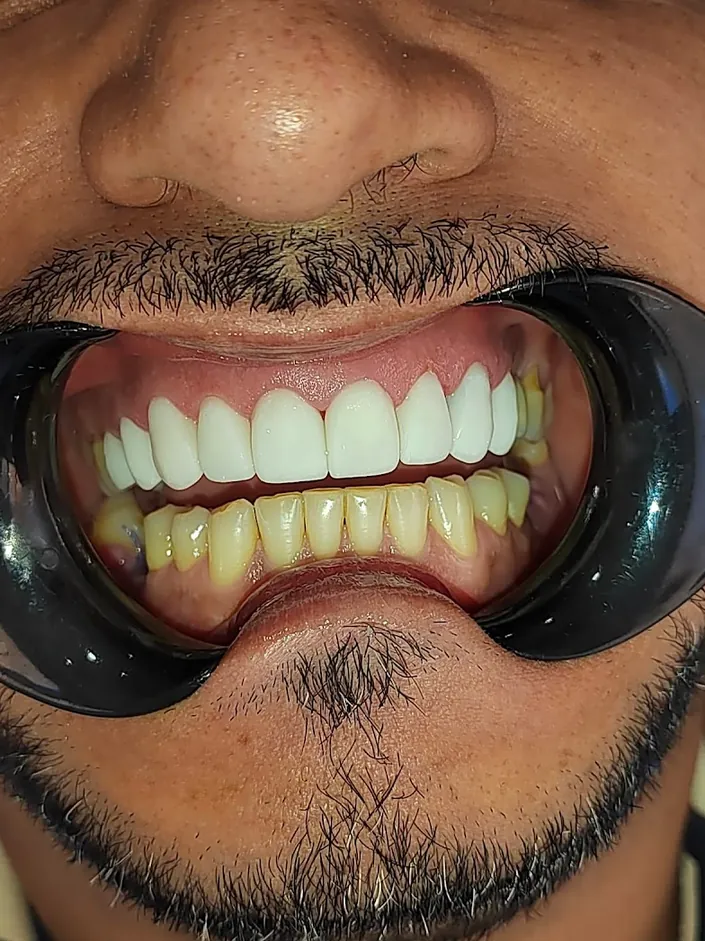 FullDental Bogotá | Implantes Dentales, Diseño de Sonrisa y Ortodoncia