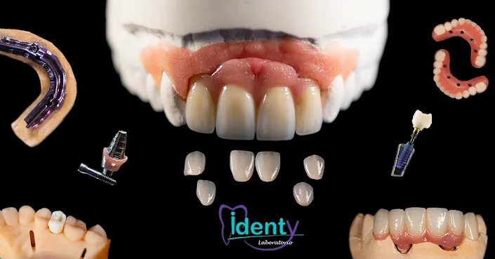 IDENTY – Laboratorio dental