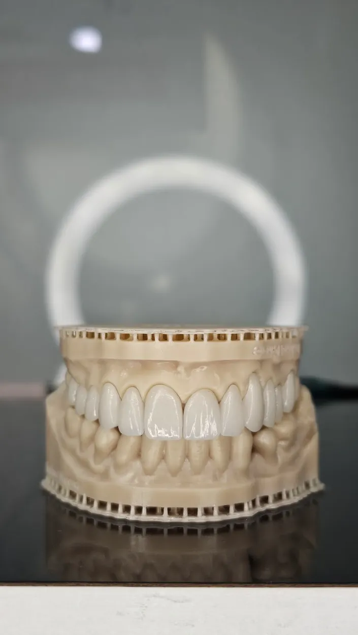 Jonatan Solano Alta Estética Dental