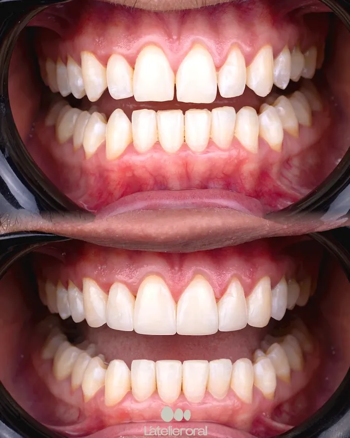 L’Atelier oral