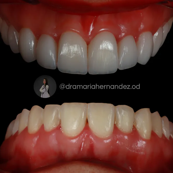 Odontología barranquilla / doctora María Hernández Odontología Estética, integral y Armonización Orofacial