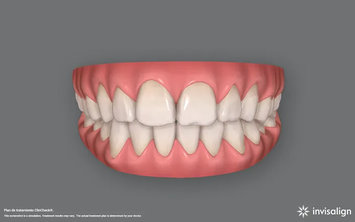 Odontología Dra. Ana Cris G. Echeverri | Ortodoncia Invisible Medellín