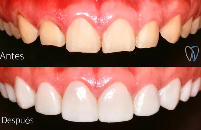 odontologia especializada dr alvaro donado