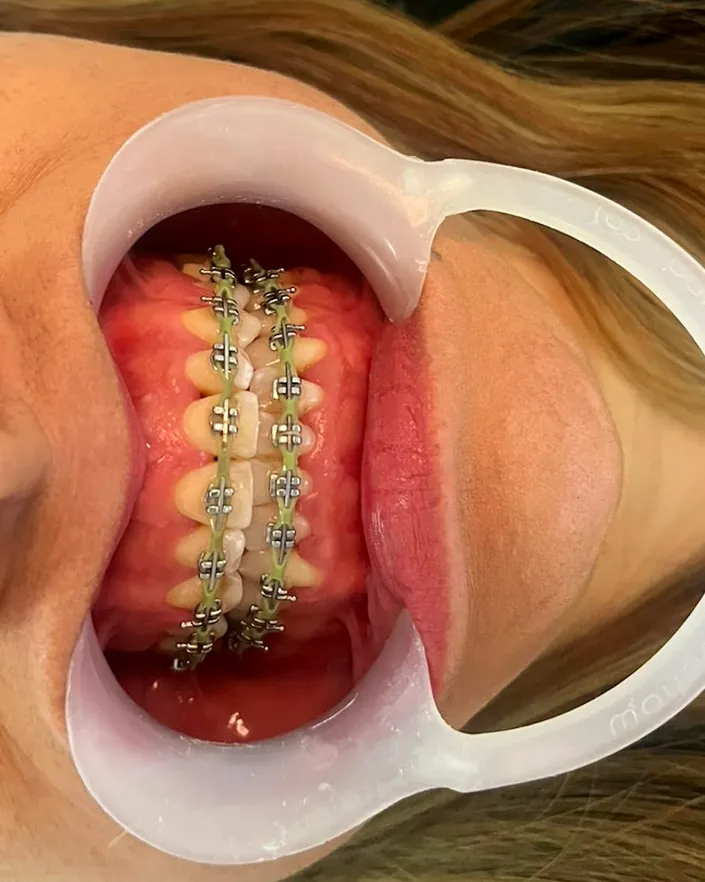 ODONTOLOGÍA