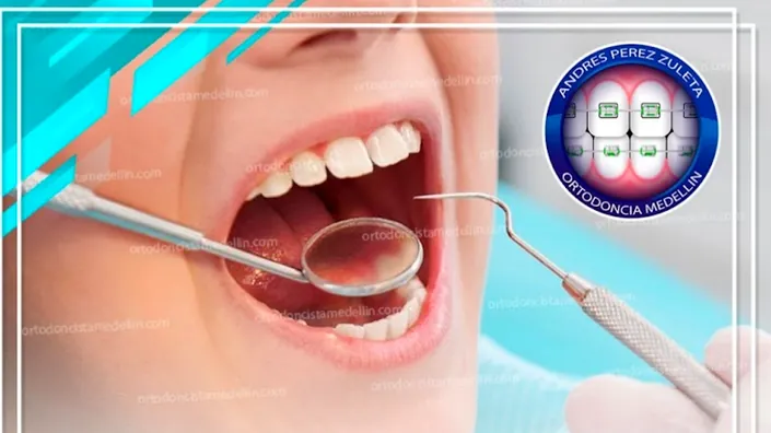 Ortodoncia Medellin Odontologo Dr. Andres Perez