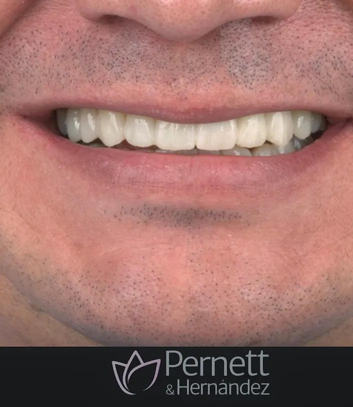 Pernett&Hernandez Odontología Estética