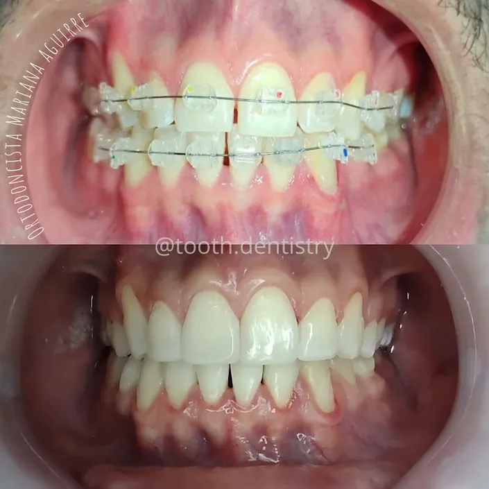 Tooth Dentistry