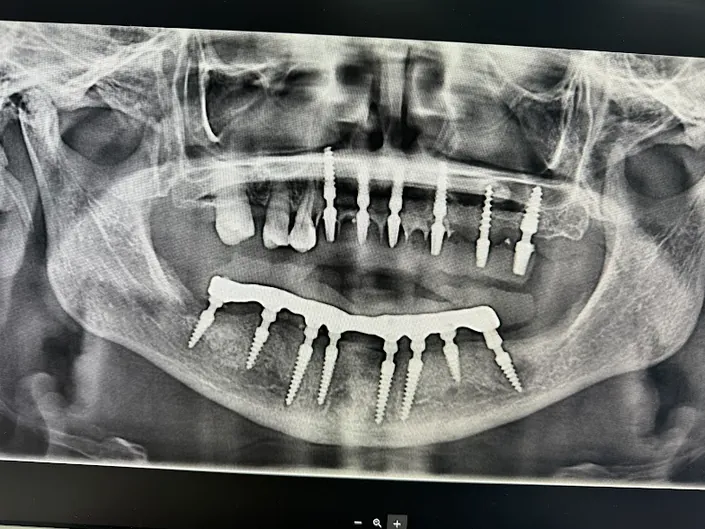 Urgencias Odontológicas – Clínica Estética Dental 24 Horas