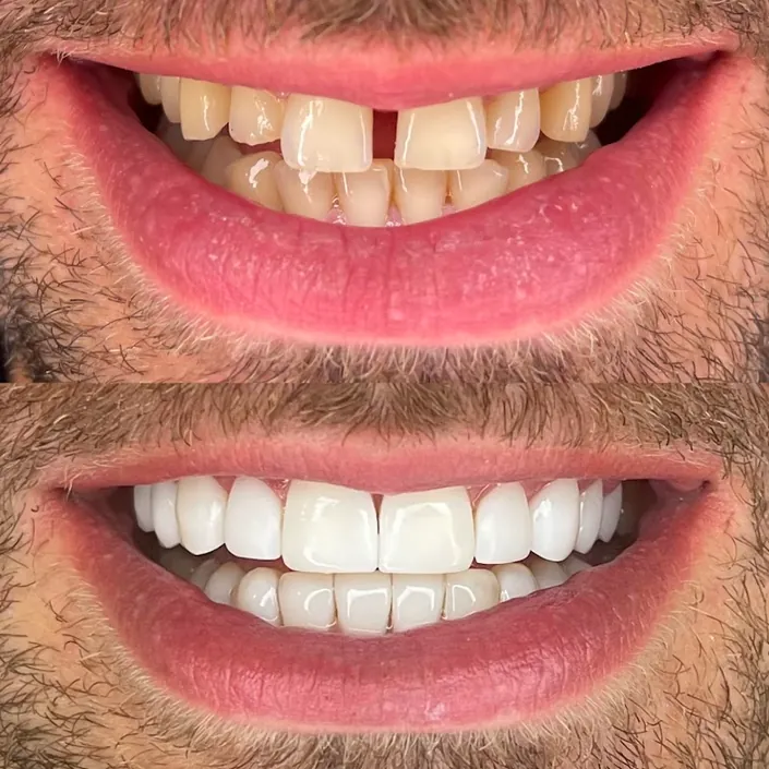 Vanidad Dental