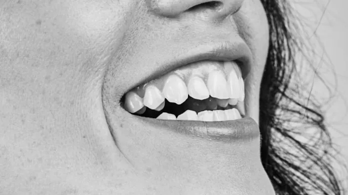 White smile odontología