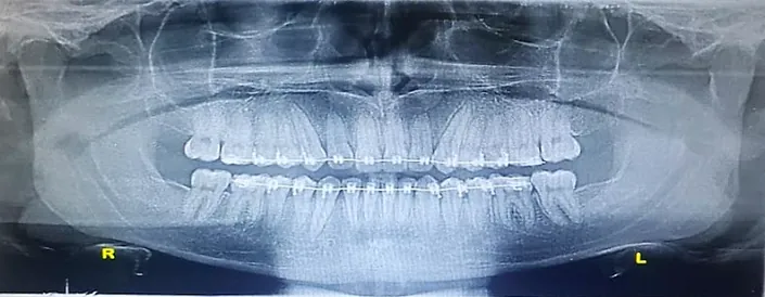 Xrayimagenes odontologicas