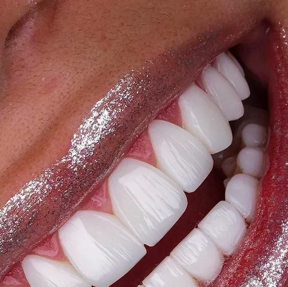 Yamile Cardenas Odontología Estética